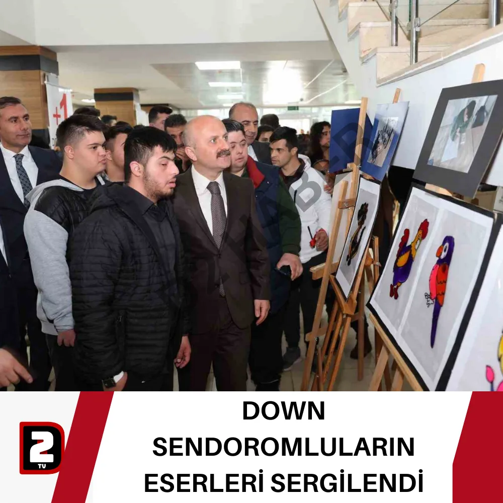 DOWN SENDOROMLULARIN ESERLERİ SERGİLENDİ 